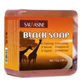 100g African Black Soap with Shea Butter – Moisturizing, Deep-Cleansing Acne Treatment Bar for Clear, Glowing Skin