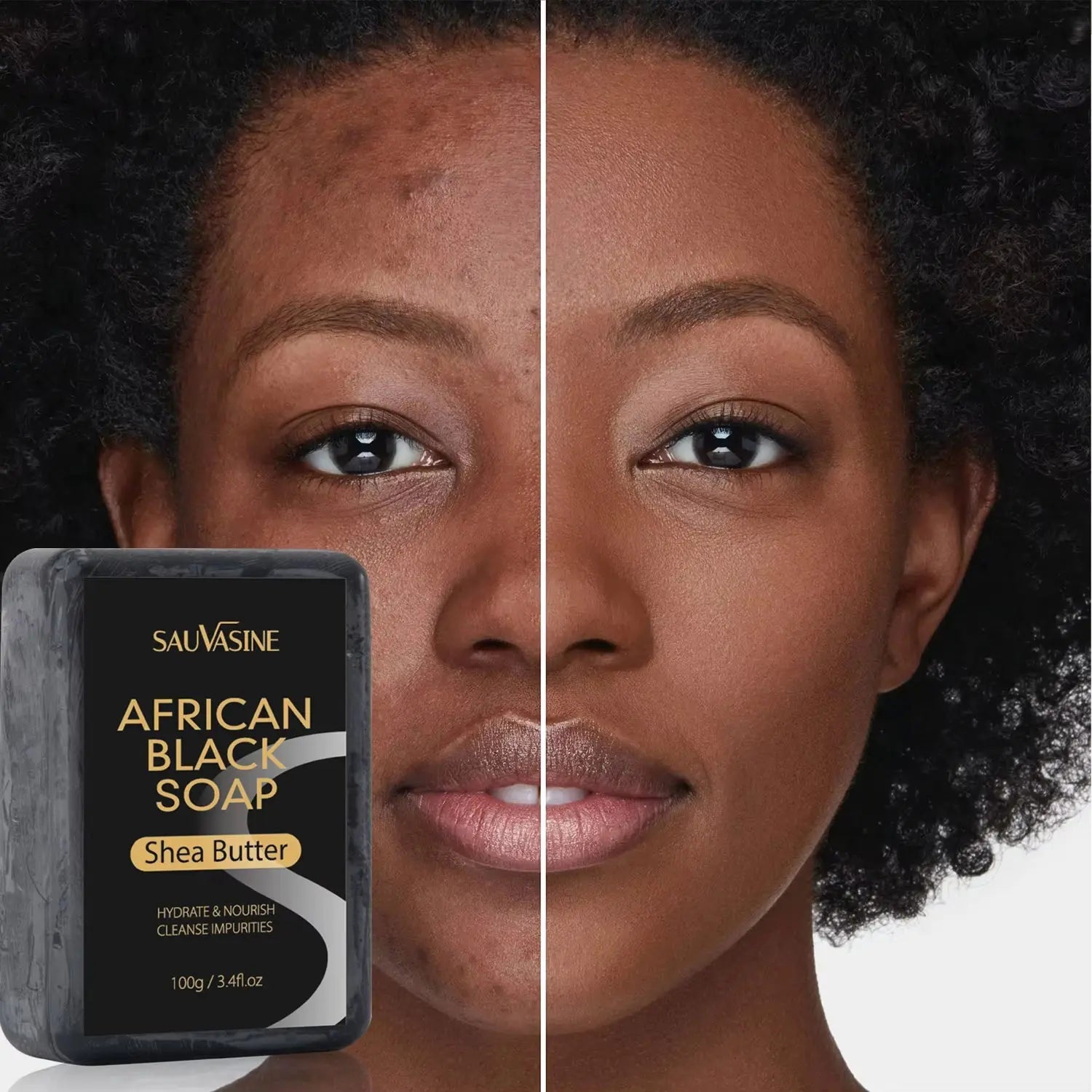 100g African Black Soap with Shea Butter – Moisturizing, Deep-Cleansing Acne Treatment Bar for Clear, Glowing Skin